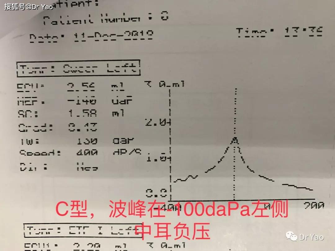 卫光生物获得发明专利授权：“一种抗A、抗B血凝素滴度测定方法”